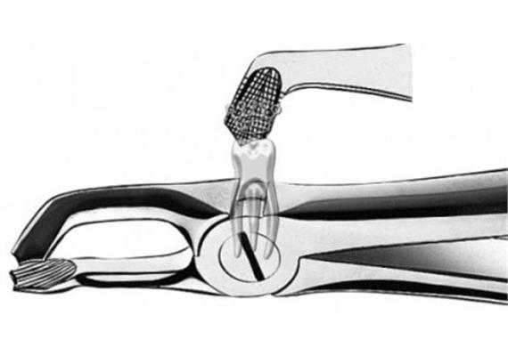 C.Martin Zahnzange E79