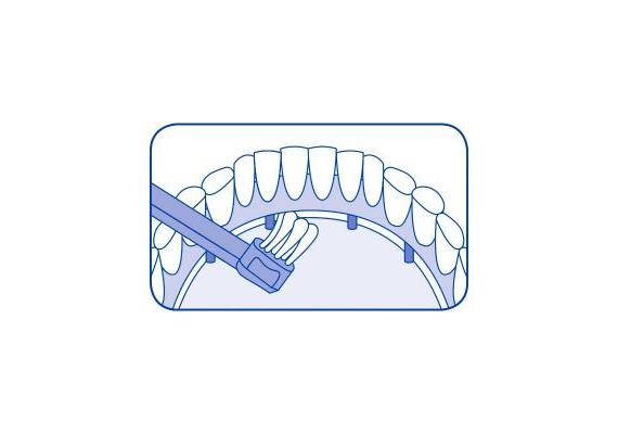 Curaprox CS-708 Implant Ortho Cello
