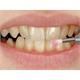 Hager+Werken Mira-Clin P