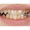 Hager+Werken Mira-Clin P