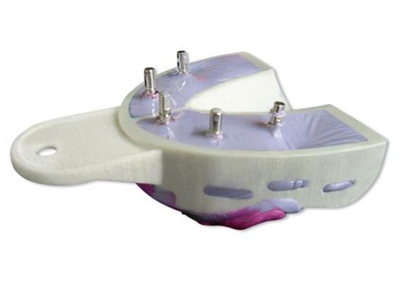 Hager+Werken Miratray Implant UK L1 small