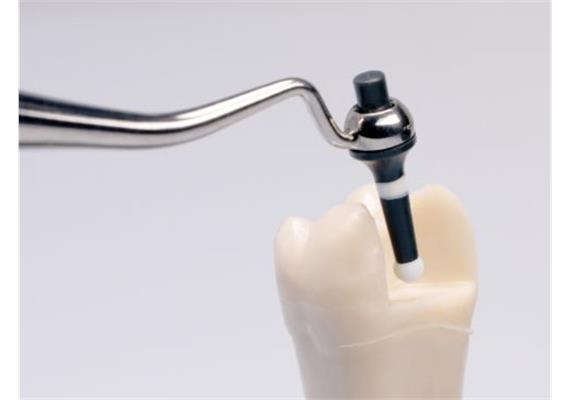 Optrasculpt Kugel Refill